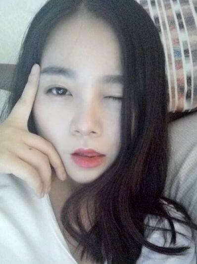 隆鼻整形日记 重庆铂生硅胶隆鼻+耳软骨鼻尖