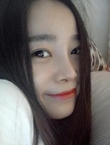 隆鼻整形日记 重庆铂生硅胶隆鼻+耳软骨鼻尖