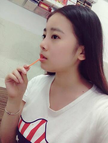 隆鼻整形日记 重庆铂生硅胶隆鼻+耳软骨鼻尖