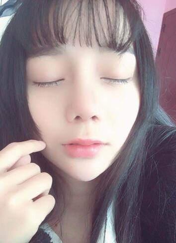 隆鼻修复术后恢复期经历