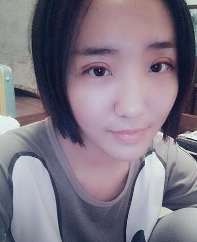 全切双眼皮2个月恢复图