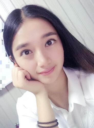 微创双眼皮恢复过程图