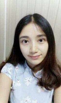 微创双眼皮恢复过程图