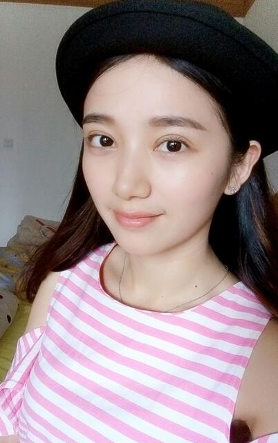 微创双眼皮恢复过程图