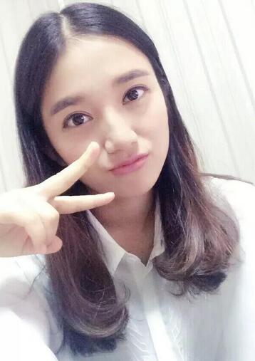 微创双眼皮恢复过程图