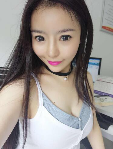 发际线调整案例分享 北京熙朵发际线+眉毛种植