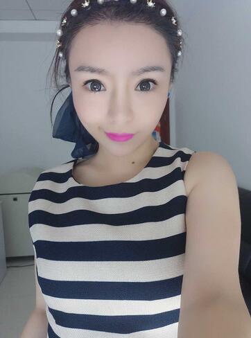 发际线调整案例分享 北京熙朵发际线+眉毛种植