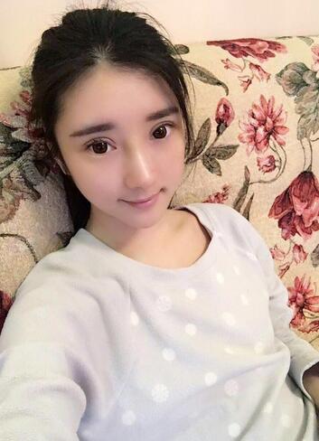 双眼皮修复+自体脂肪填充恢复日记