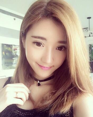 双眼皮修复+自体脂肪填充恢复日记