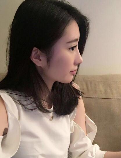 双眼皮修复+自体脂肪填充恢复日记