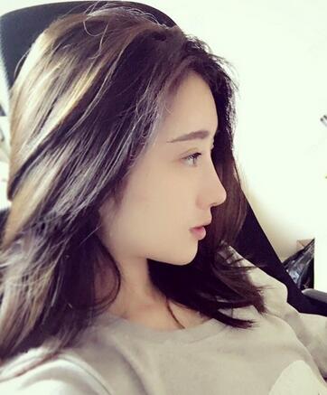 双眼皮修复+自体脂肪填充恢复日记