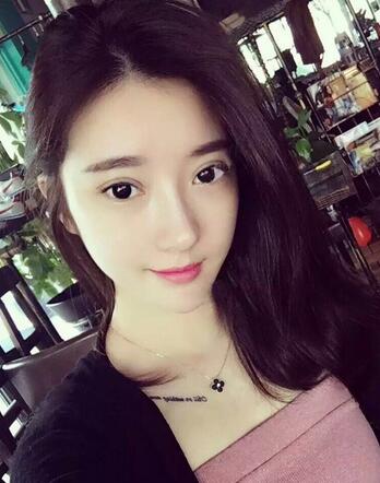 双眼皮修复+自体脂肪填充恢复日记