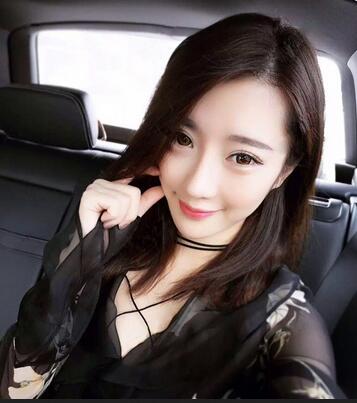 双眼皮修复+自体脂肪填充恢复日记