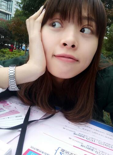 北京熙朵全切双眼皮1个月恢复日记