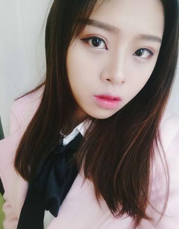 北京熙朵全切双眼皮1个月恢复日记