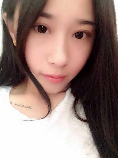 切开双眼皮消肿过程图