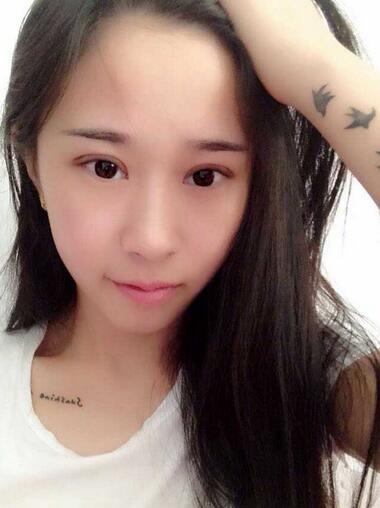 切开双眼皮消肿过程图