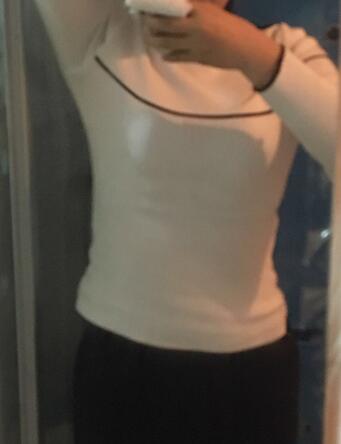 腰腹部吸脂后一个月照片