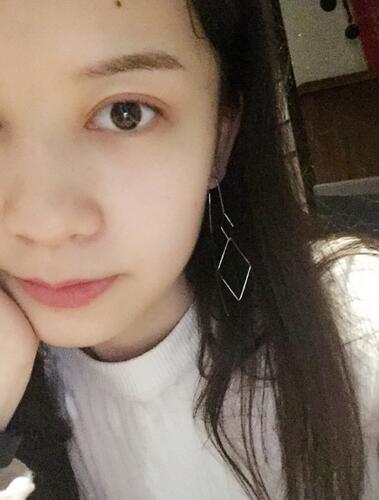 切开双眼皮+开眼角消肿恢复过程图