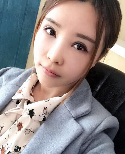 自体脂肪填充全脸恢复经历