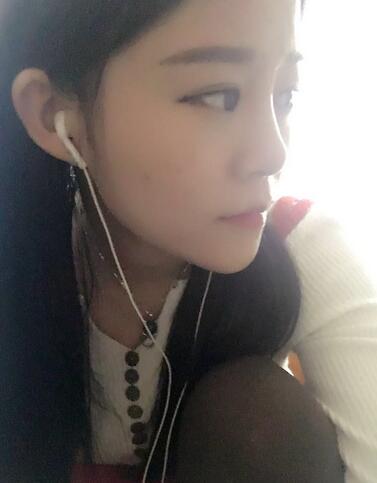 玻尿酸隆鼻恢复过程图