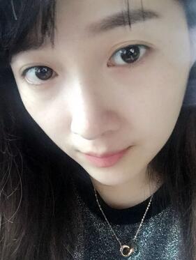 去鱼尾纹的很好方法 注射瘦脸去鱼尾纹果分享