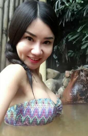 假体隆胸果自然吗 假体隆胸亲身经历