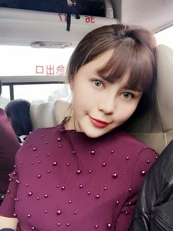 韩式生科三段隆鼻术后恢复经历