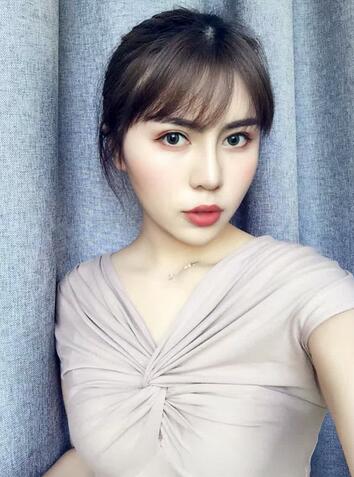 韩式生科三段隆鼻术后恢复经历