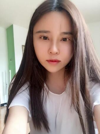自体脂肪填充+双眼皮多项整形+隆鼻整形3个月恢复日记
