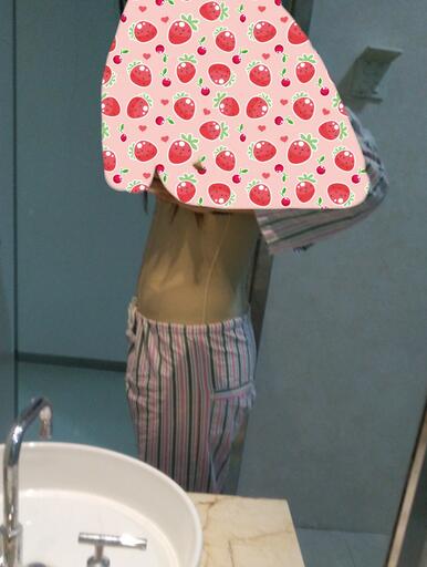 腰腹抽脂3个月的感受