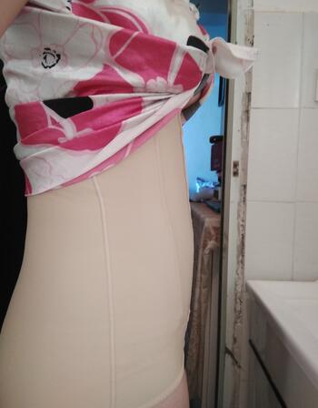 腰腹抽脂3个月的感受