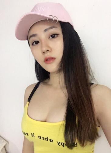 重庆好美自体脂肪隆胸已经一个月了