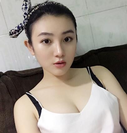 重庆好美自体脂肪隆胸已经一个月了