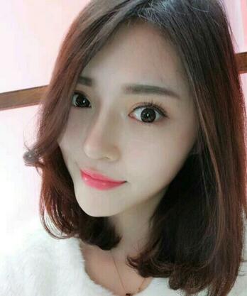 隆鼻整形1个月真实恢复期图片