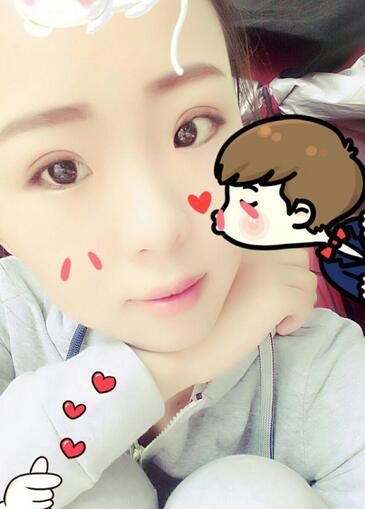 割双眼皮术后恢复过程 全切双眼皮3个月