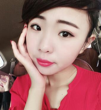 割双眼皮术后恢复过程 全切双眼皮3个月