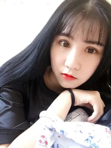 切的双眼皮90天恢复过程图