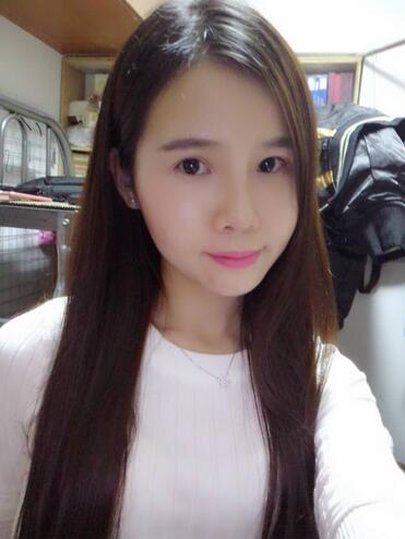 自体脂肪填充后2个月图