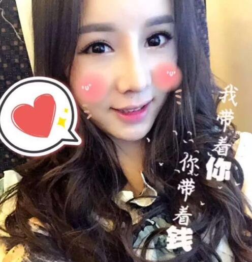 隆隆鼻整形隆鼻1个月