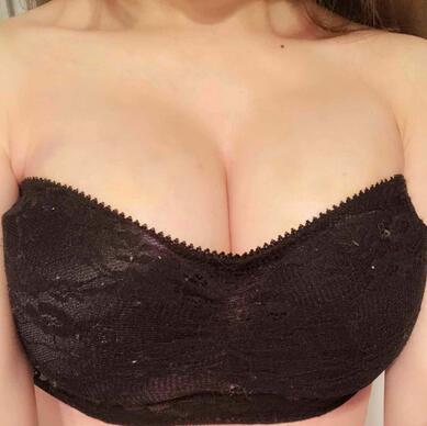 自体脂肪丰胸之后多久能上班 北京丽星丰胸恢复纪实