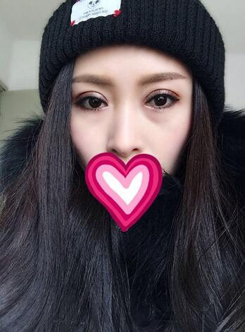 北京丽星双眼皮修复半年了