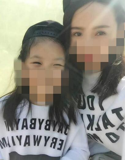 北京丽星双眼皮修复半年了