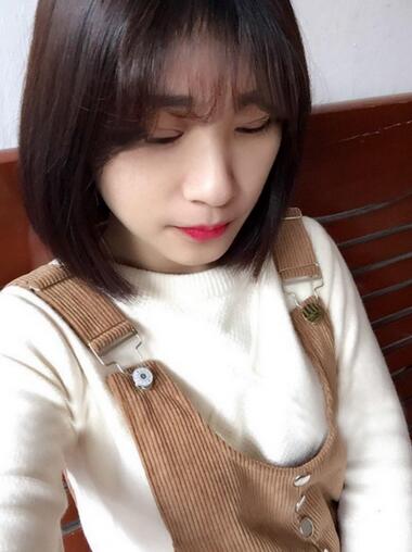 微创定点每天恢复过程图 北京丽星双眼皮3个月