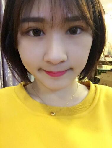 微创定点每天恢复过程图 北京丽星双眼皮3个月