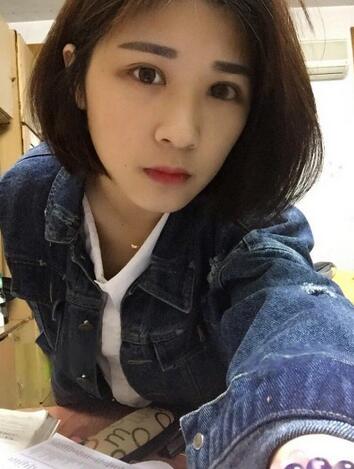 微创定点每天恢复过程图 北京丽星双眼皮3个月