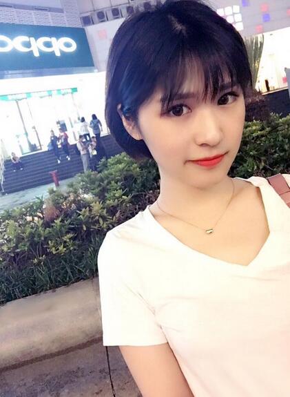 微创定点每天恢复过程图 北京丽星双眼皮3个月