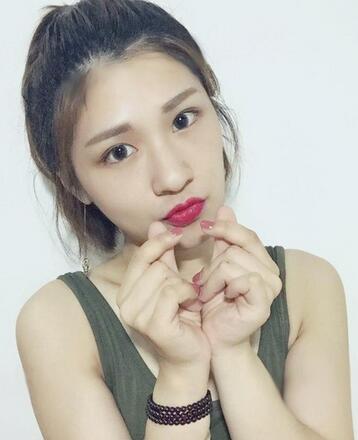 微创定点每天恢复过程图 北京丽星双眼皮3个月