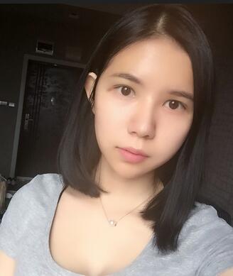 自体脂肪填充恢复日志 自体脂肪填充太阳穴+额头