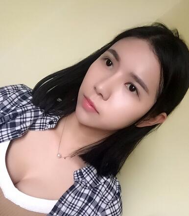 自体脂肪填充恢复日志 自体脂肪填充太阳穴+额头